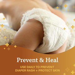 Lanolin-rich A+D formula moisturizes and soothes dry, irritated skin.