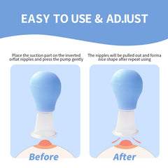 Azure nipple suckers being applied demonstrates simple suction over the nipple.