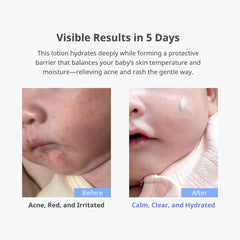 CHA&MOM bottle with dispensing cap enables easy, mess-free application.