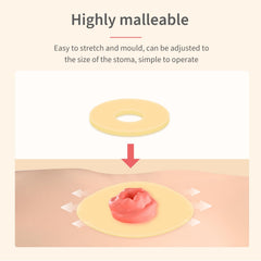 DERAYMI ostomy ring waterproof design supports travel and daily activity.