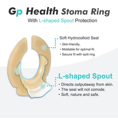 Giiiiump stoma ring demonstrates flexible, moldable design for all stoma sizes.