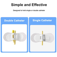 Gyinere feeding tube holder application demonstrates easy removal and reattachment.
