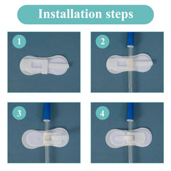 HNYG catheter stabilization device anchors tubes to reduce movement.