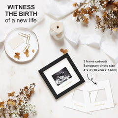 KINLINK Ultrasound Frame wall display showing 4x3 photo in a sleek 6x6 frame.