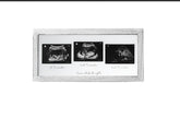 KyNora Rustic White Frame front view, a timeless nursery ultrasound keepsake.