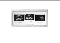 KyNora Rustic White Frame front view, a timeless nursery ultrasound keepsake.