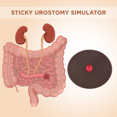 MedEduQuest stoma model in multiple sizes for versatile clinical scenario practice.