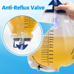 NorBeng anti-reflux valve shown on the bag to prevent backflow.