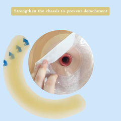 Shanzhinan ostomy barrier strip secures the bag and skin during movement.
