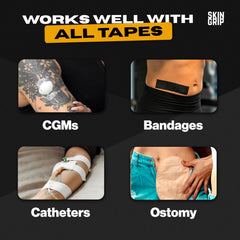 Skin Grip barrier wipe for ostomy care to protect skin and reduce irritation.