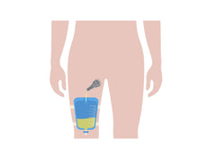 TOPMED ETS adhesive-strip attachment for quick and secure fitting