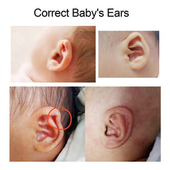 ZJchao self-cutting ear corrector stickers, customizable to fit baby ears.