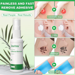 ZnnaYoha ostomy care scene demonstrates gentle adhesive lift