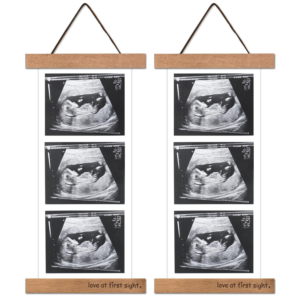 Zyeco wooden sonogram frame on fridge displays ultrasound photos neatly