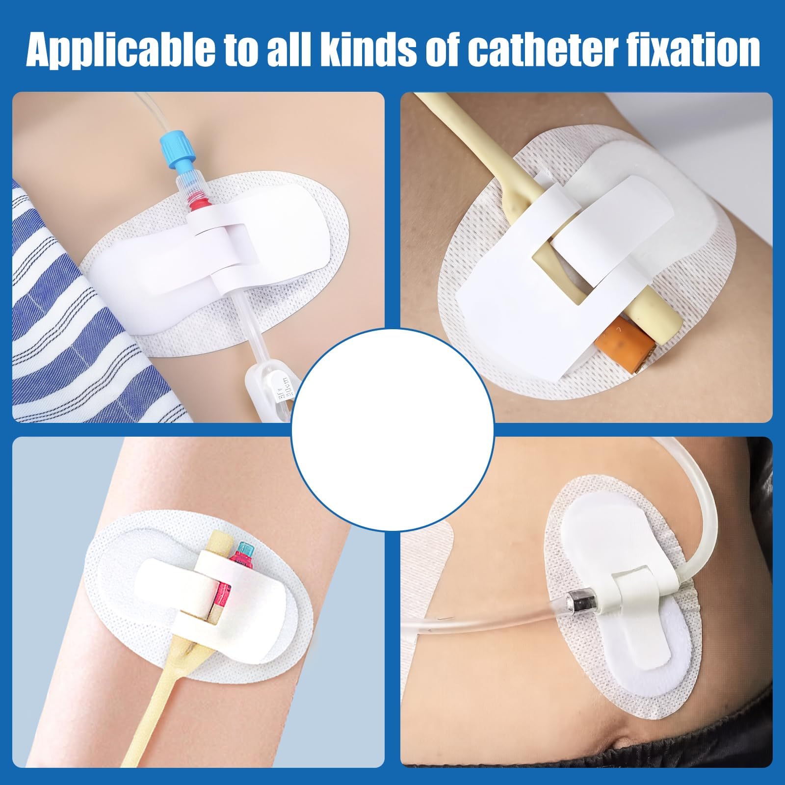 Asofelk double fixation system illustrates a two-tube setup for flexible care.