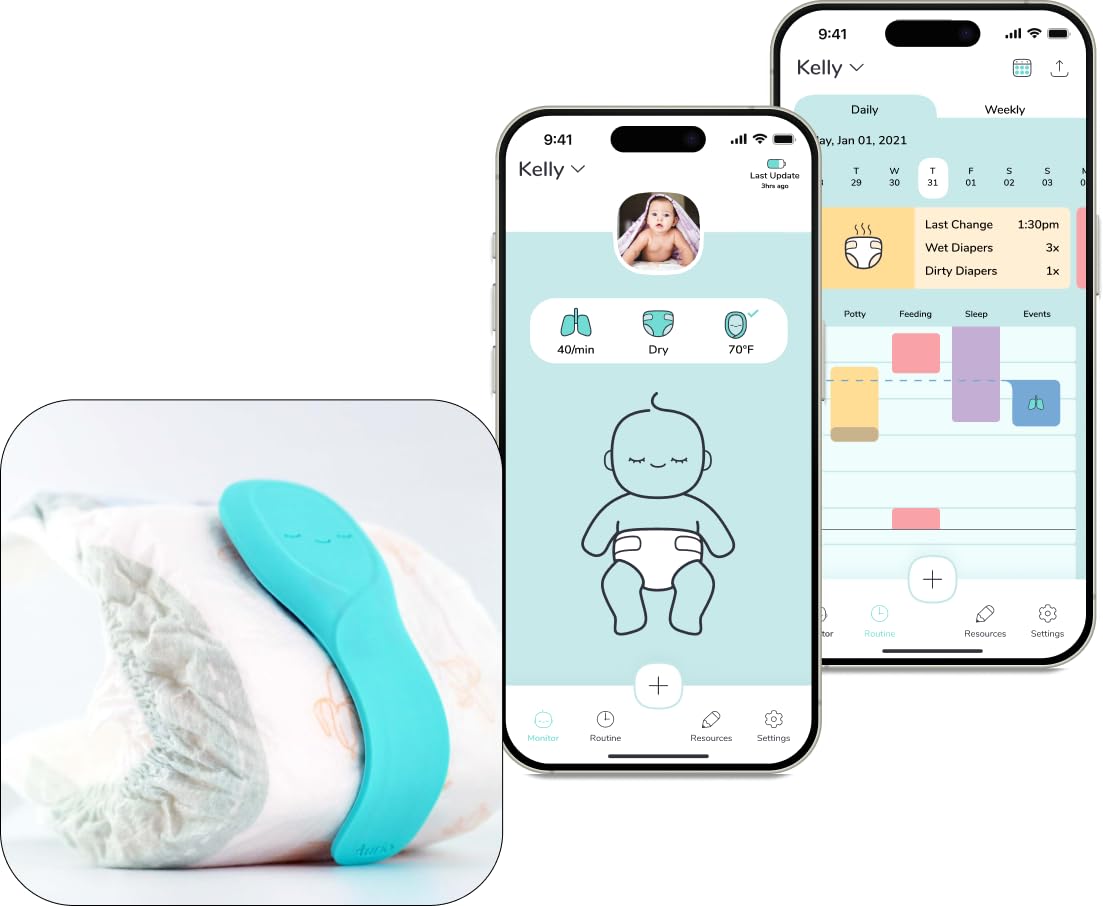 Aurio smart baby monitor front view with compact, baby-safe design for cribside use.