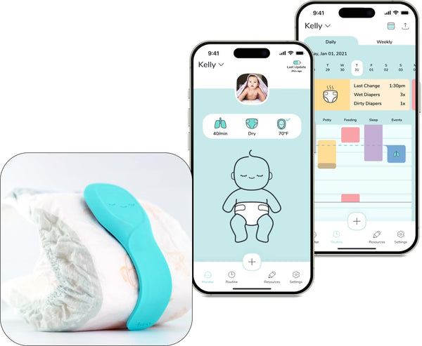Aurio smart baby monitor front view with compact, baby-safe design for cribside use.