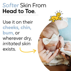 BioGaia Baby Probiotic Ointment on a baby’s hand illustrating multi-use portability.