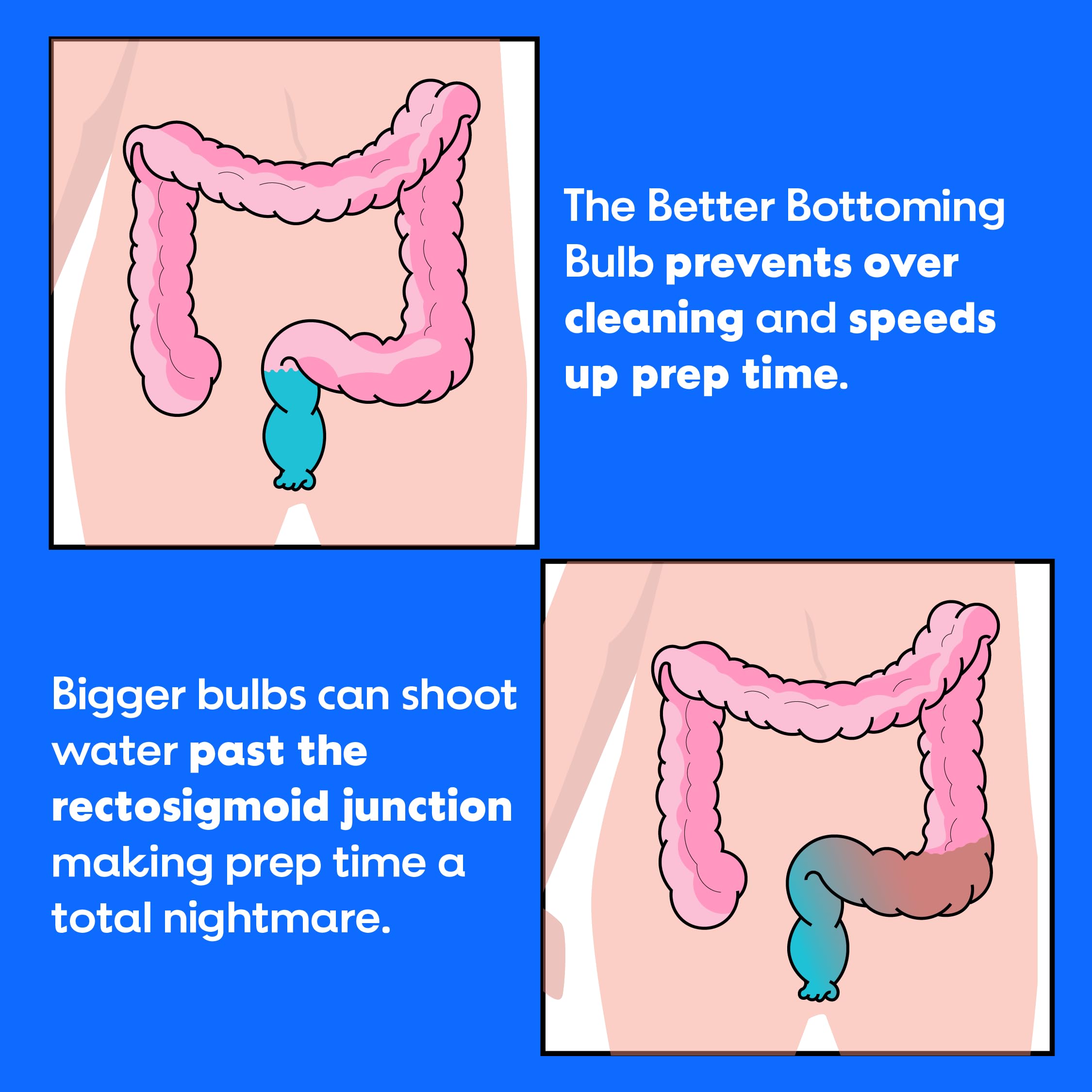 Bottom's Digest enema bulb 6 cm white tip close-up, easy-clean design.
