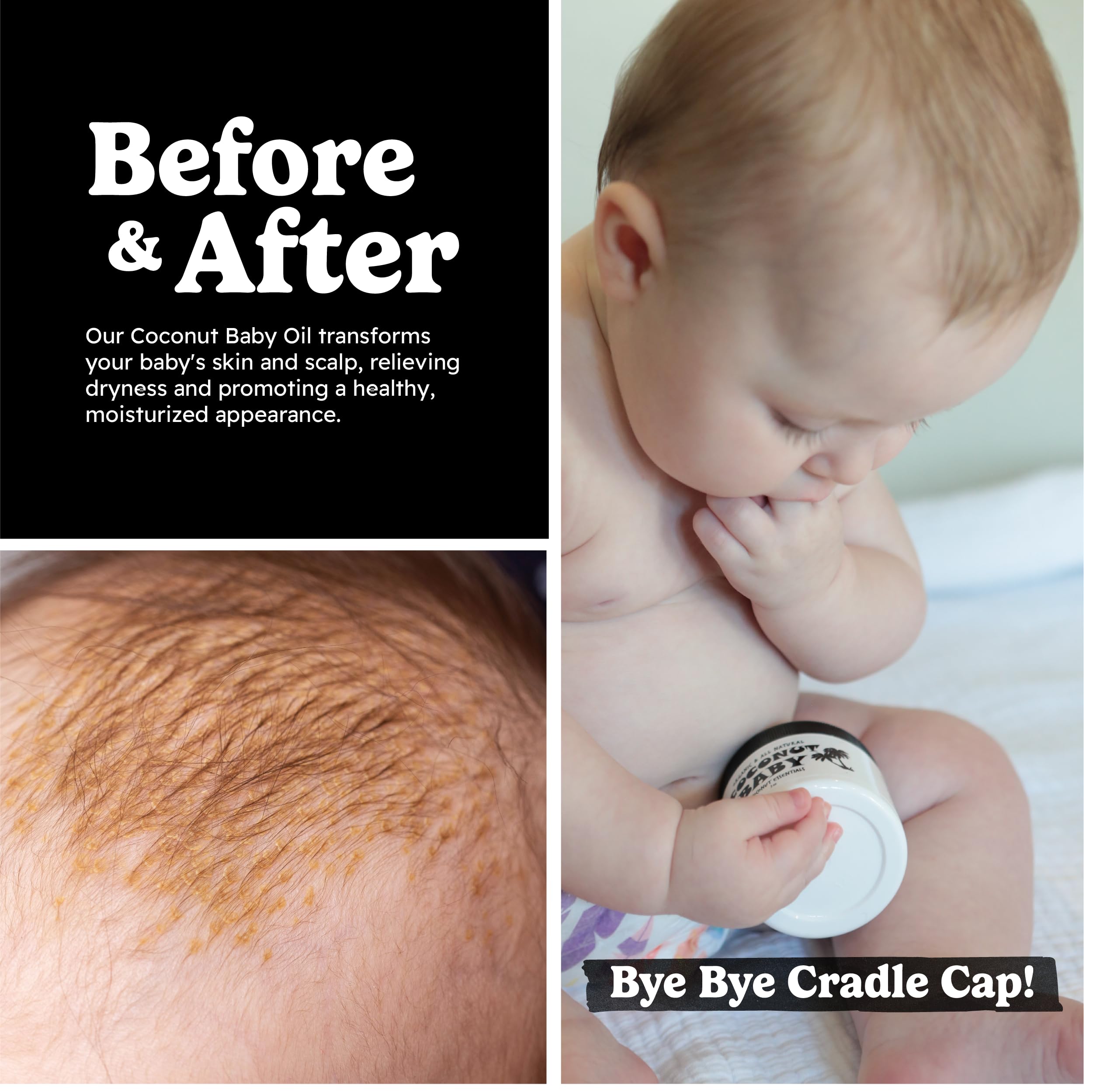 Coconut Essentials baby and adult moisturizer for soft, protected skin.