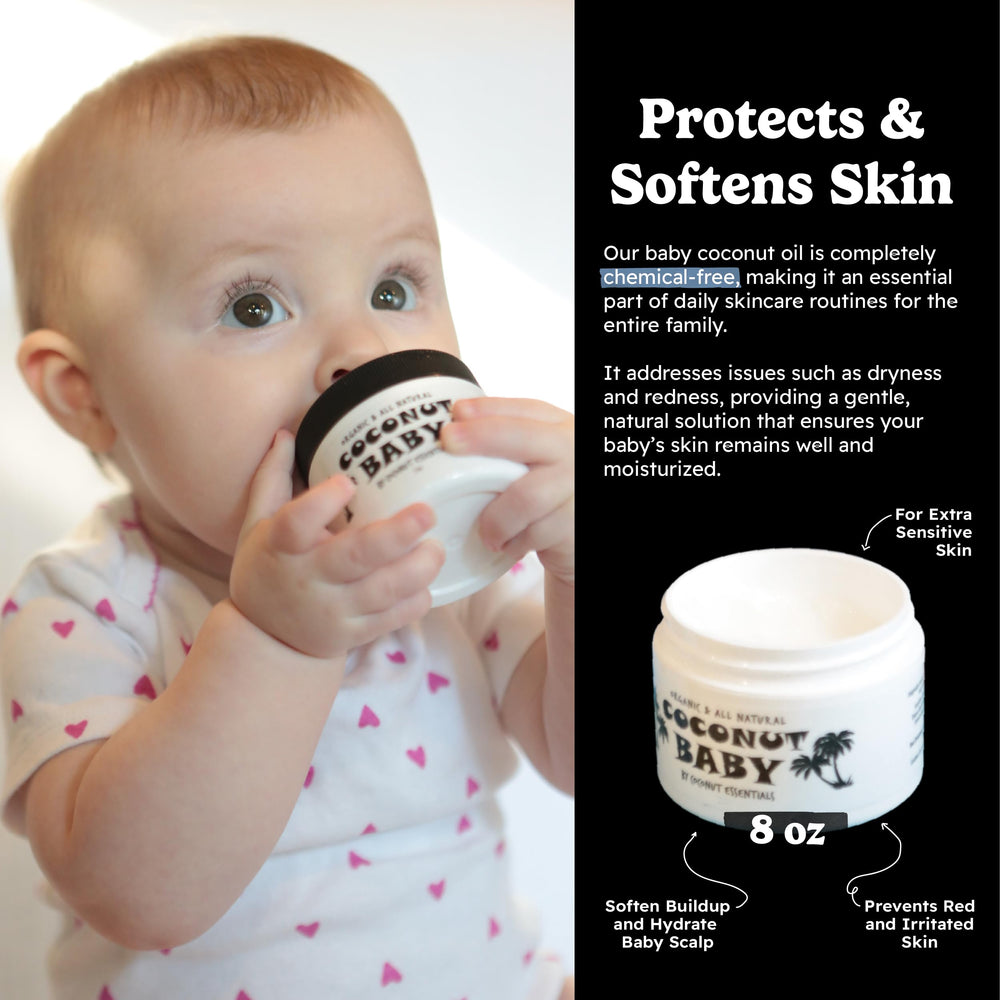 Coconut Essentials cradle cap relief for newborn scalp.