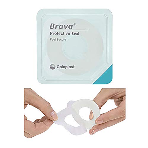 Coloplast Brava Thick Moldable Seal Ring around a stoma site provides a snug, leak-resistant seal