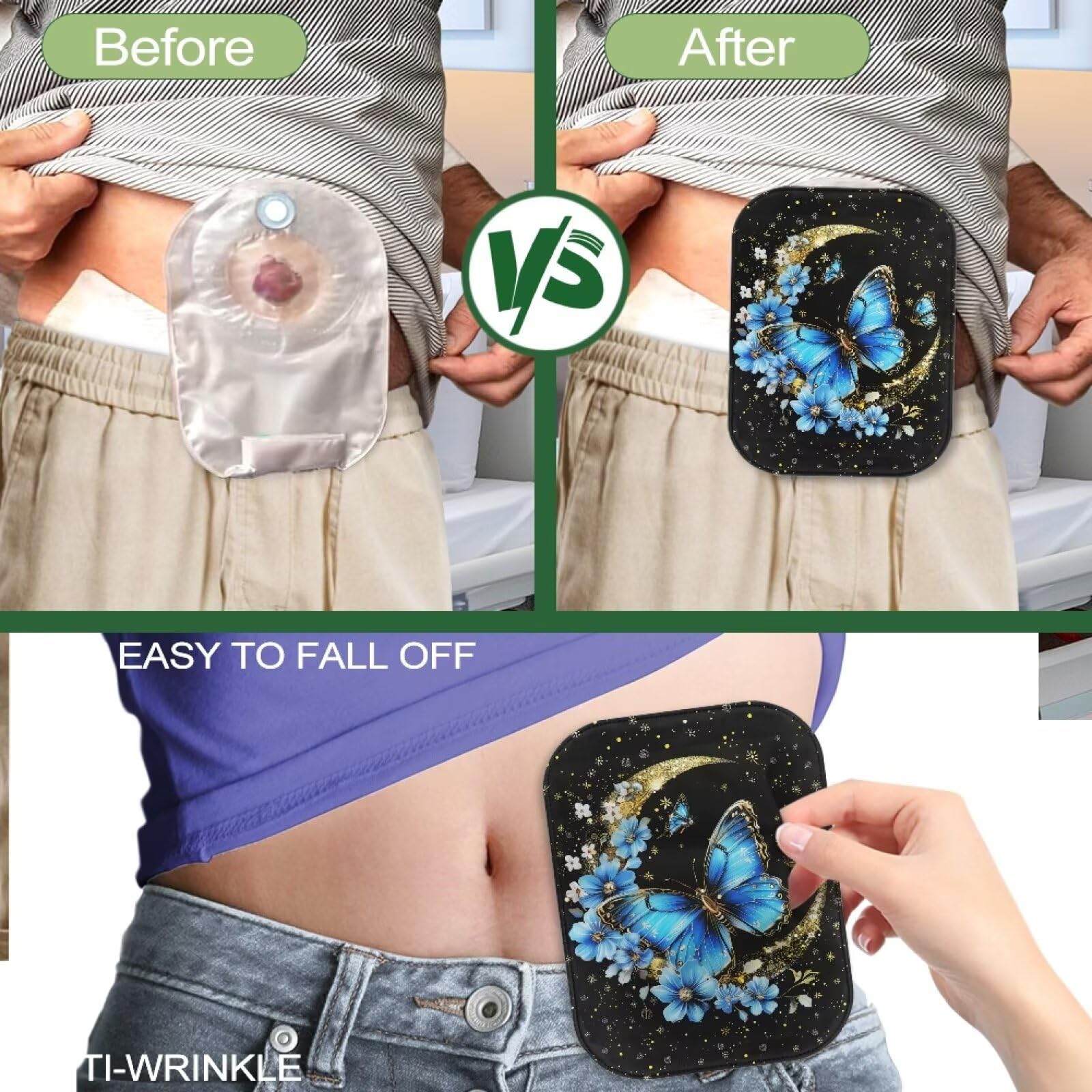 Cugasmaru Butterfly Moon ostomy cover supports versatile use during sports and sleep.
