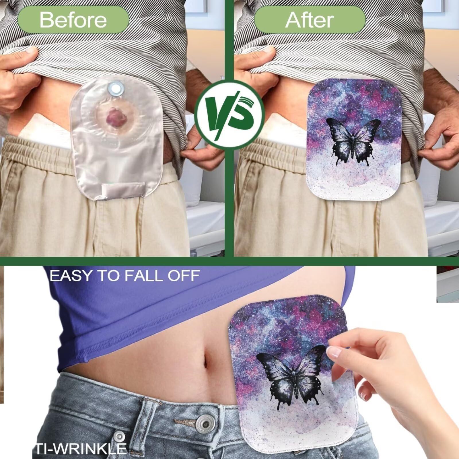 Cugasmaru butterfly purple ostomy cover presented as a thoughtful gift idea.