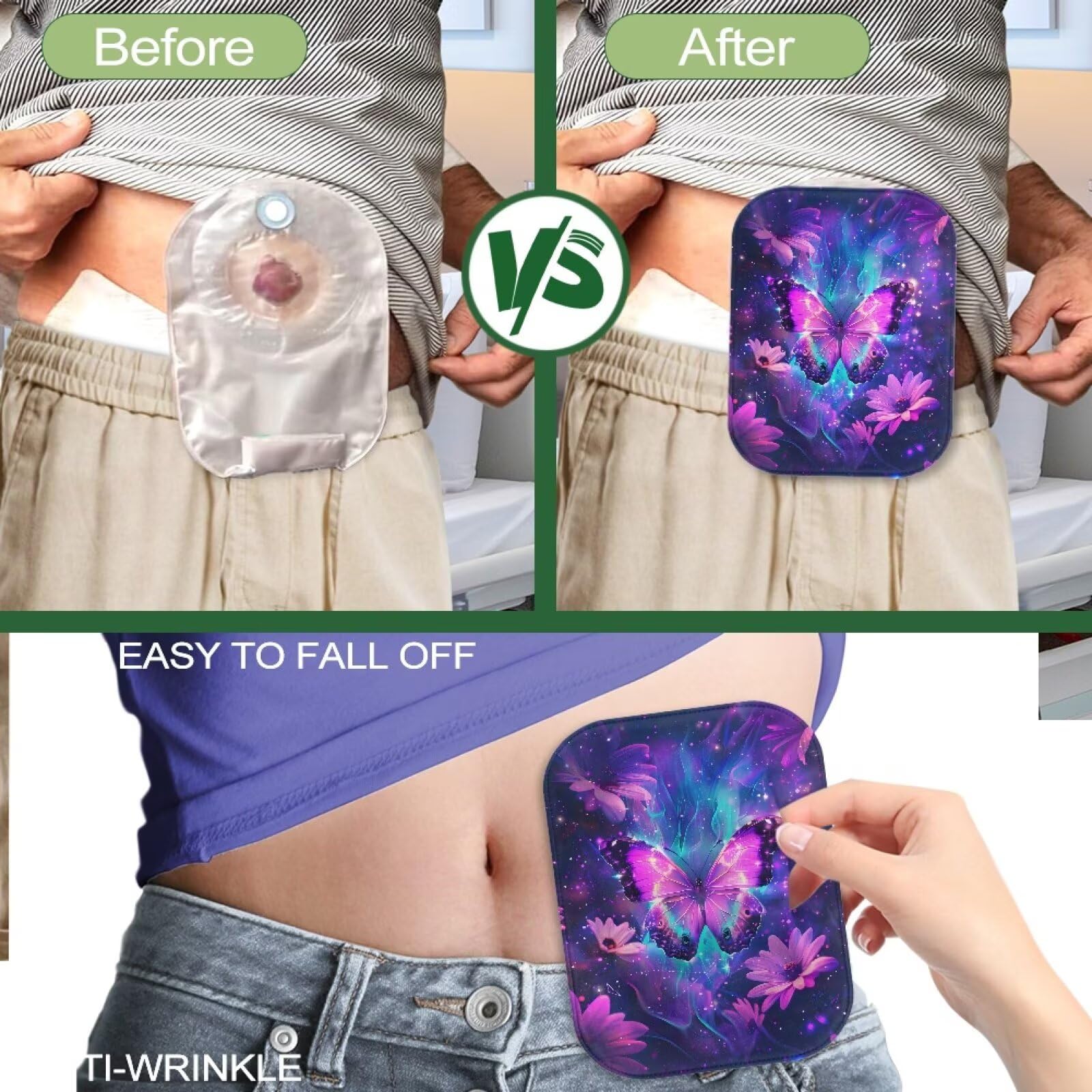 Cugasmaru versatile ostomy cover suitable for sports, sleep, and outdoor use.