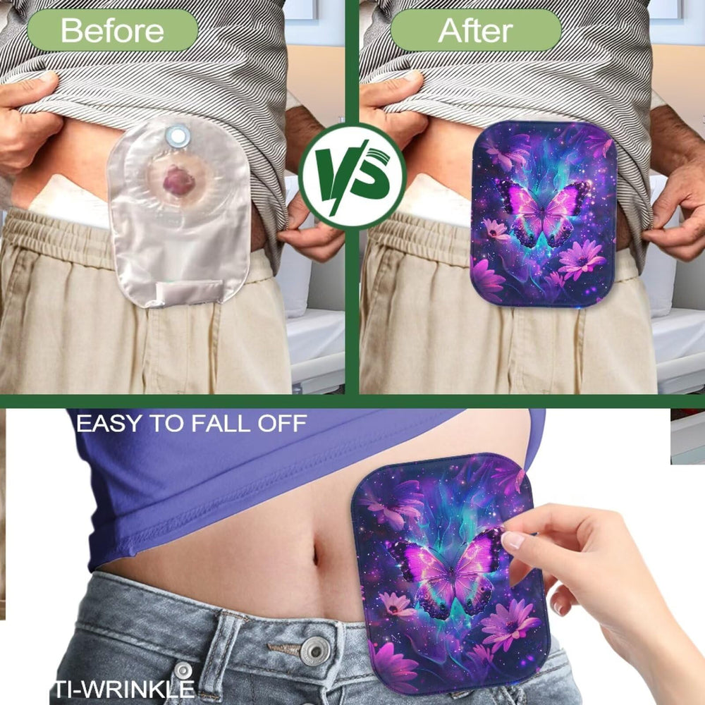 Cugasmaru versatile ostomy cover suitable for sports, sleep, and outdoor use.