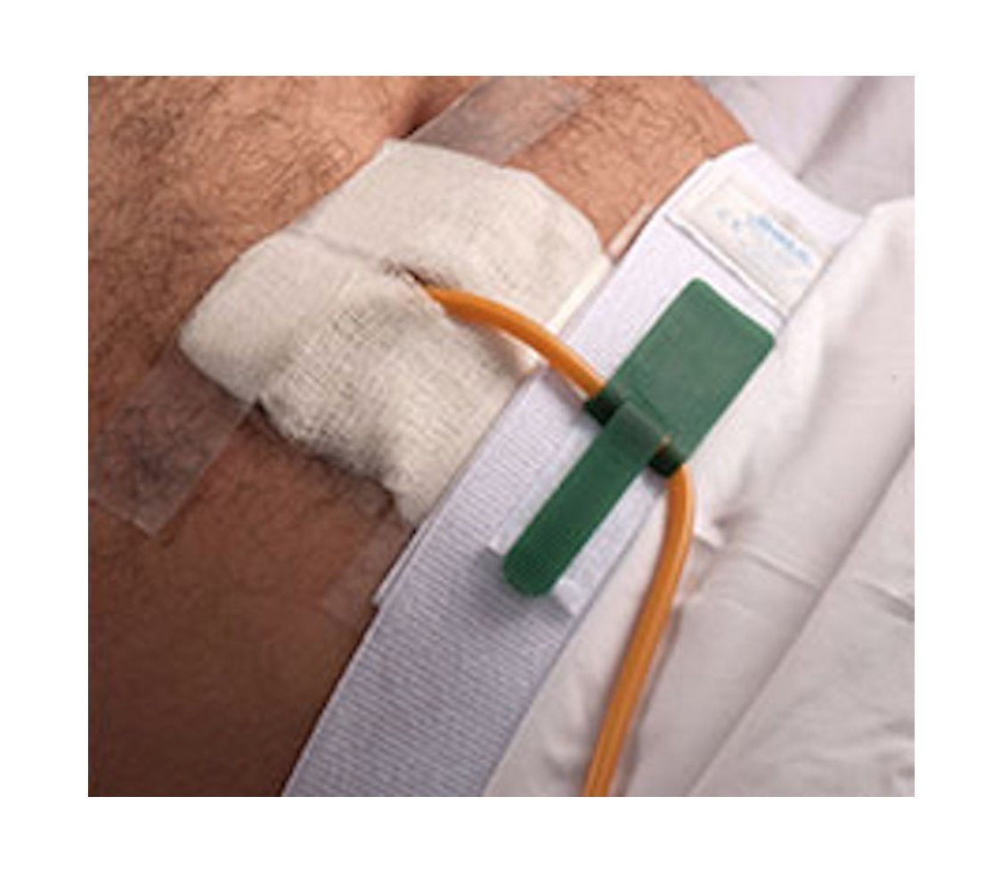 Dale Foley catheter holder waistband secures catheter for mobility and skin comfort