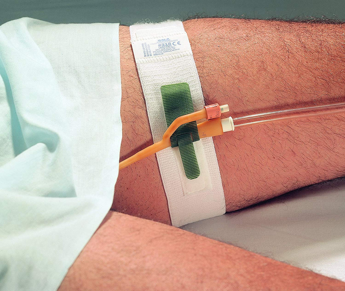 Dale Hold-N-Place Foley Catheter Holder Leg Band model 316 secures the catheter.
