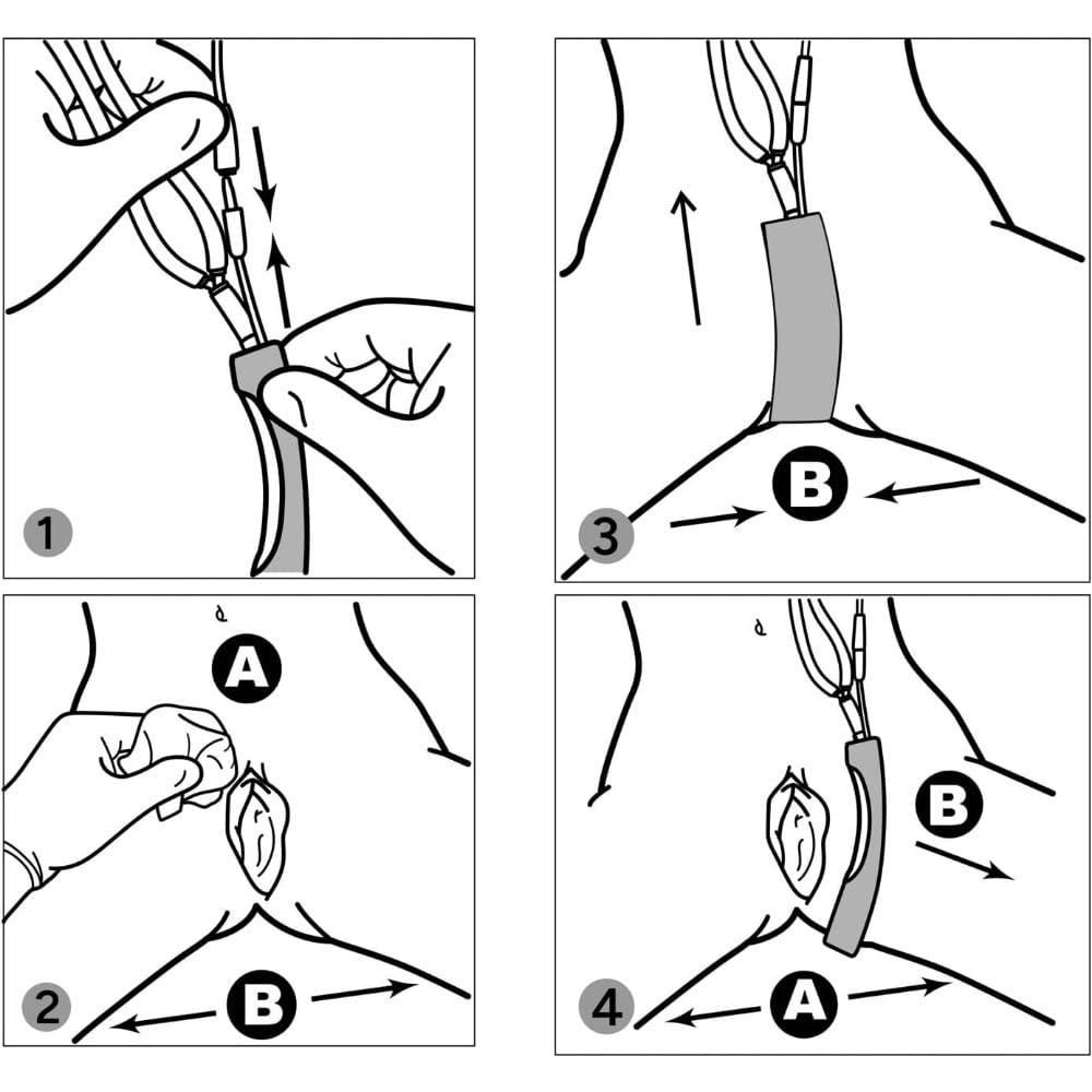 Dcroiao HOOMSOINS green external catheter 7pcs highlights included components.