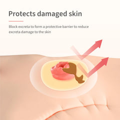 DERAYMI adhesive barrier seals stoma area during movement and activity