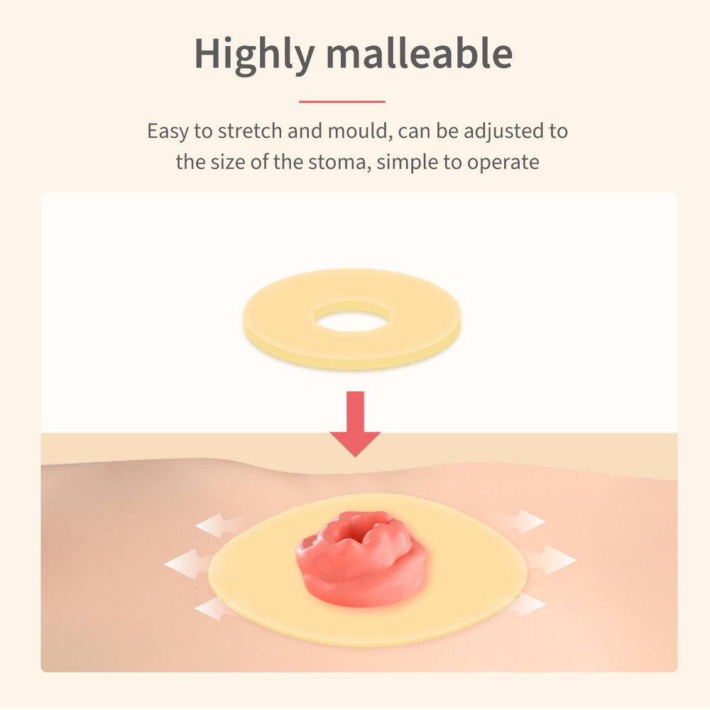 DERAYMI ostomy ring travel case image highlights discreet, on-the-go use.
