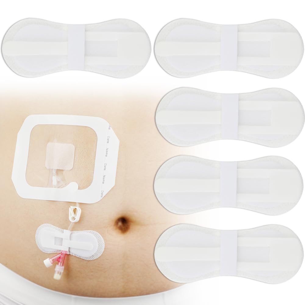 DiaBelt adhesive patch close-up securing a feeding tube with gentle grip.