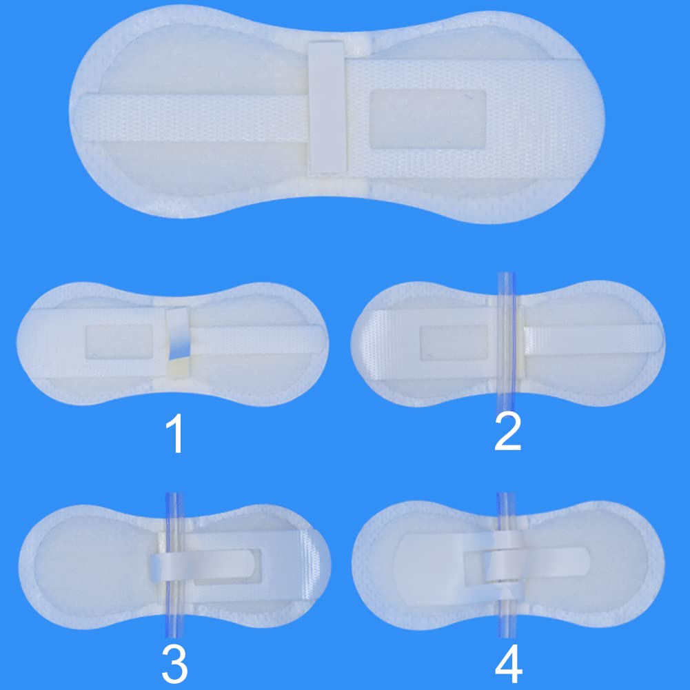 DiaBelt packaged catheter stabilization dressings ready for home dialysis and care settings.