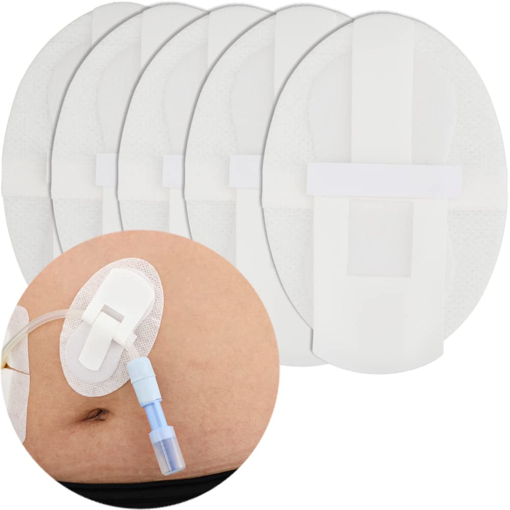 DiaBelt PD catheter adhesive patch secures tubing during daily activities