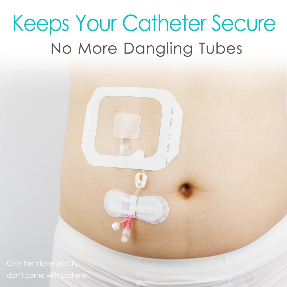 DiaBelt velcro strap detail prevents snagging and keeps tubes secure.