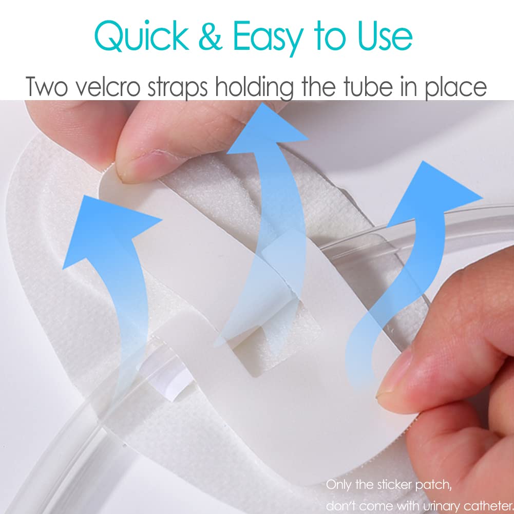 Universal tube fixation fits peg, g and j tubes securely