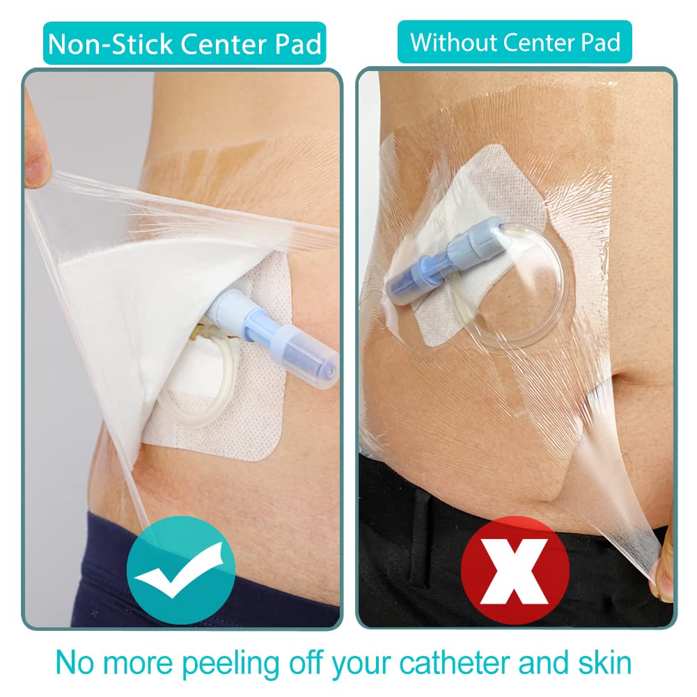 EaseToU port protection for chest or dialysis sites during showers