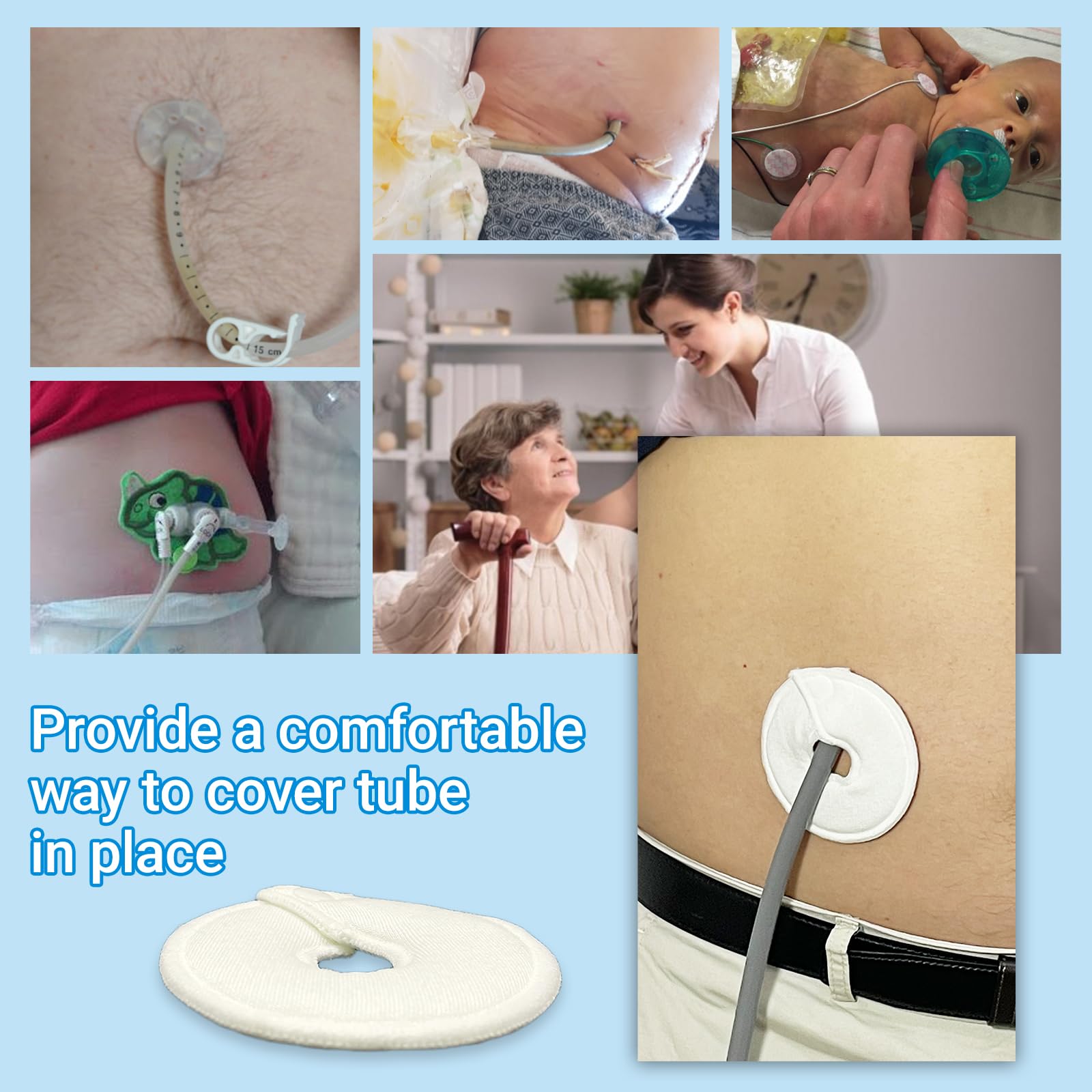 Ideal for postoperative PD and ileostomy care with reliable coverage.