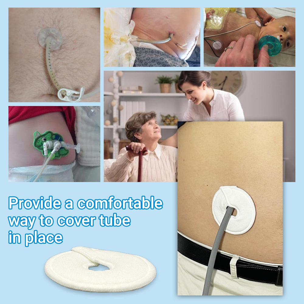 Ideal for postoperative PD and ileostomy care with reliable coverage.