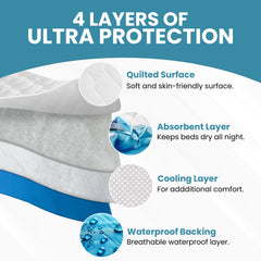 Epica bed pads top layer closeup emphasizes soft touch for skin comfort.