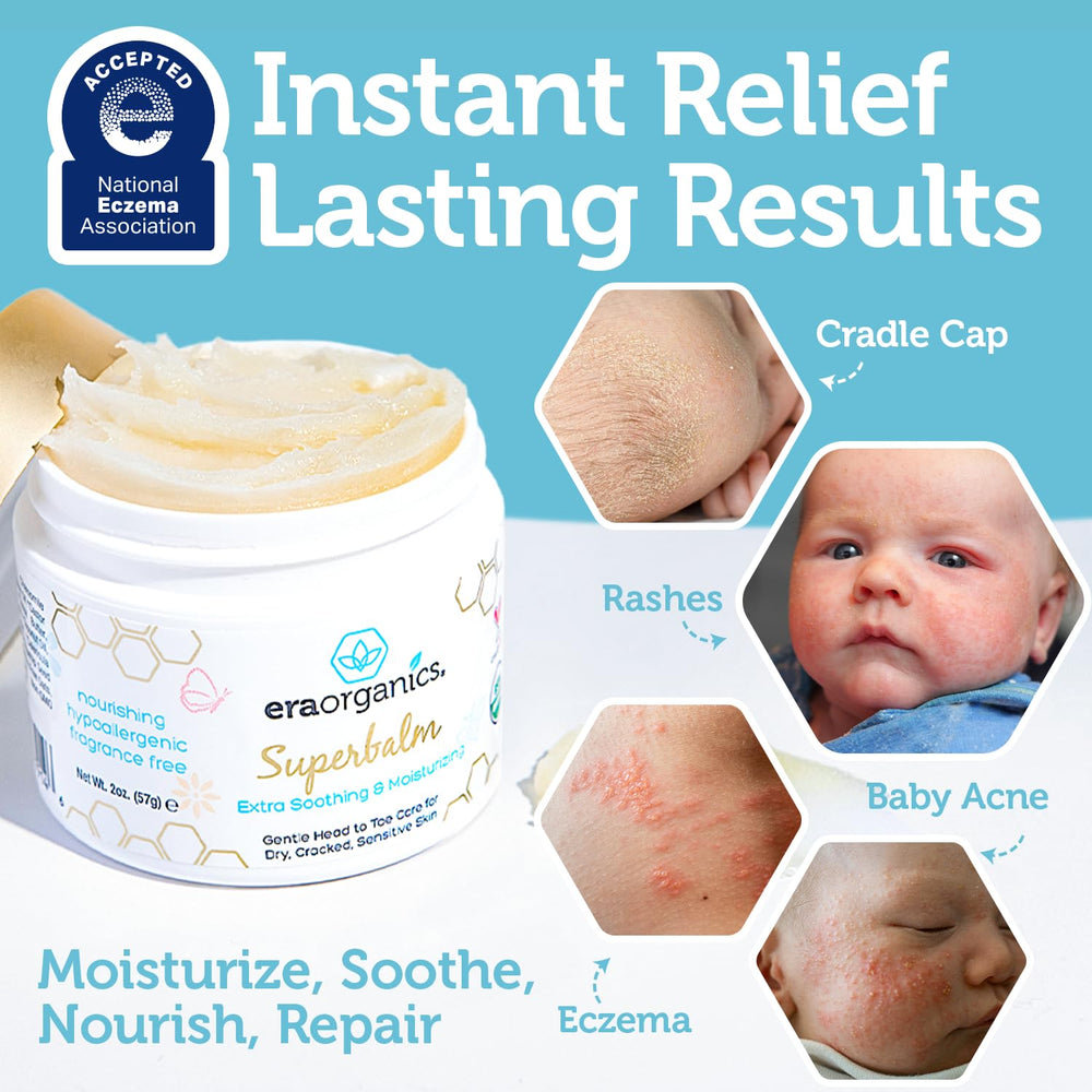 Era Organics Healing Ointment infants application demonstrates quick soothing for irritated skin.