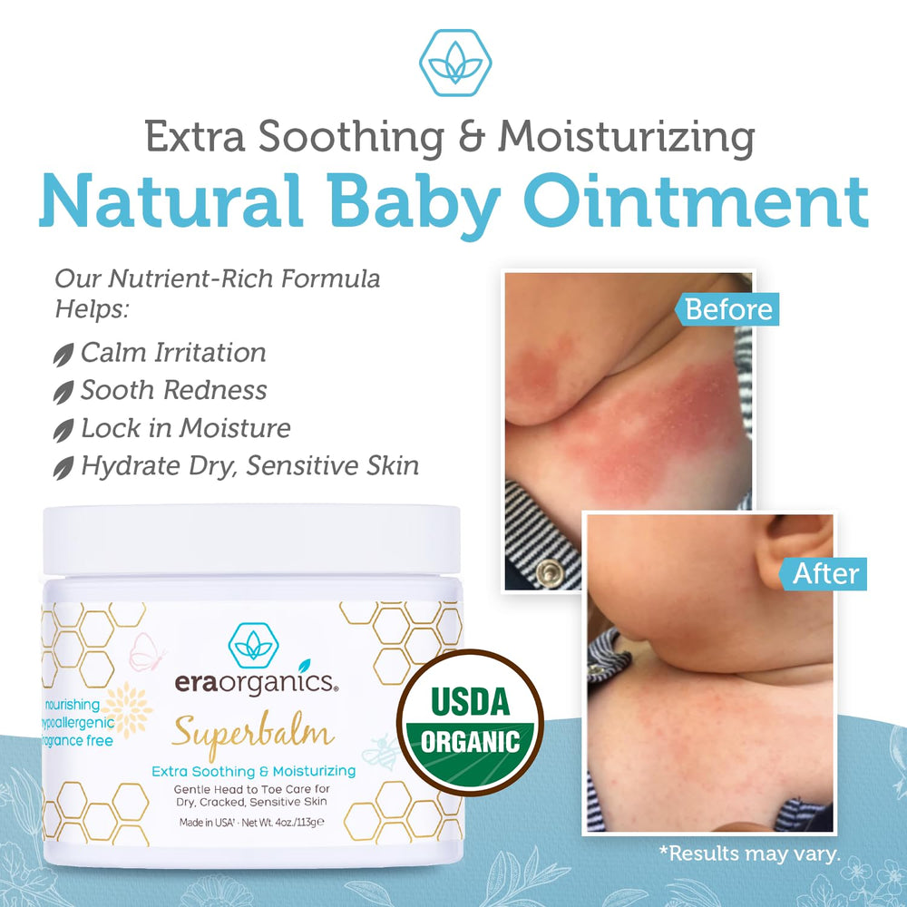 Rashes and hives care with soothing Era Organics Ointment.