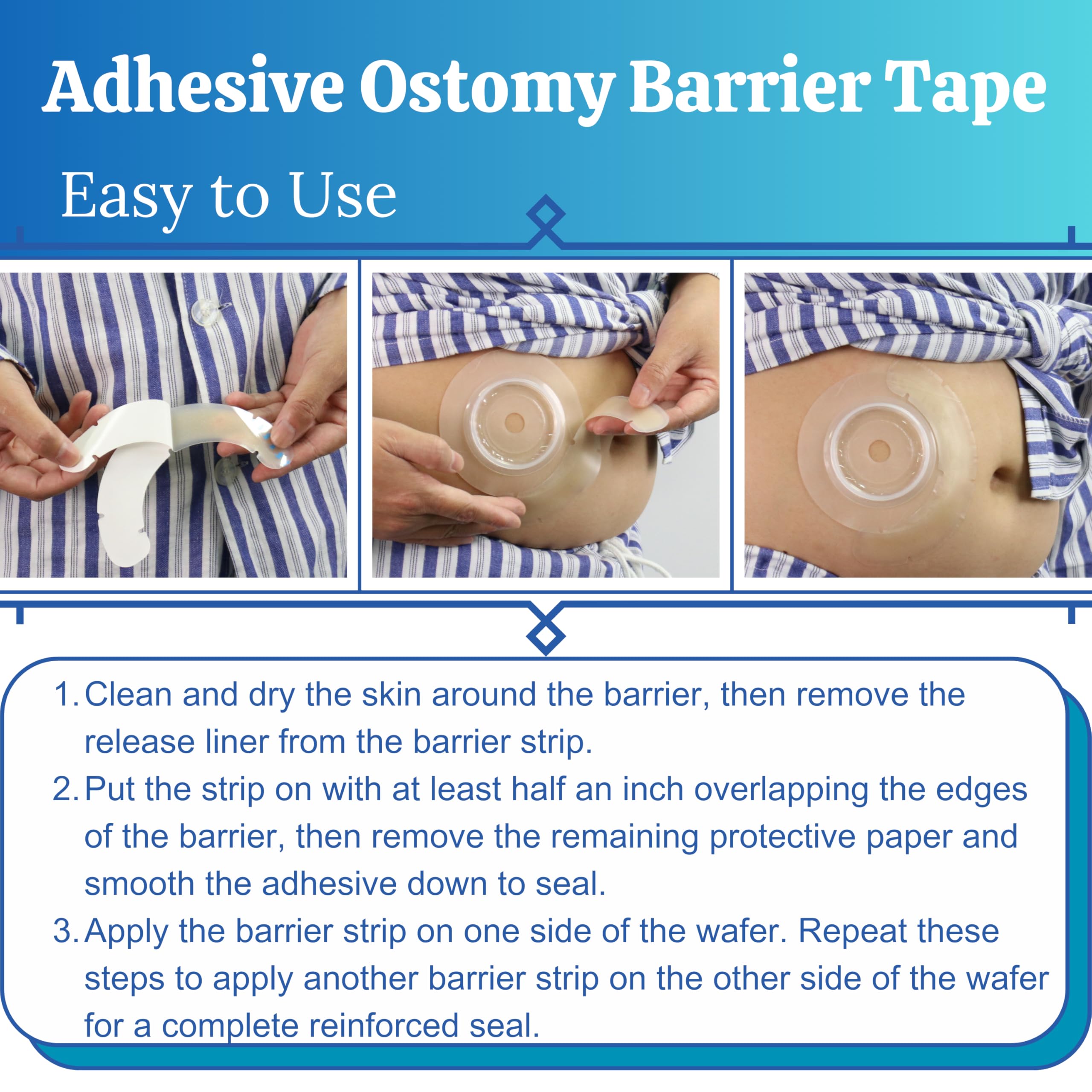 Filigan colostomy bag securing strip helps keep the bag flat against skin