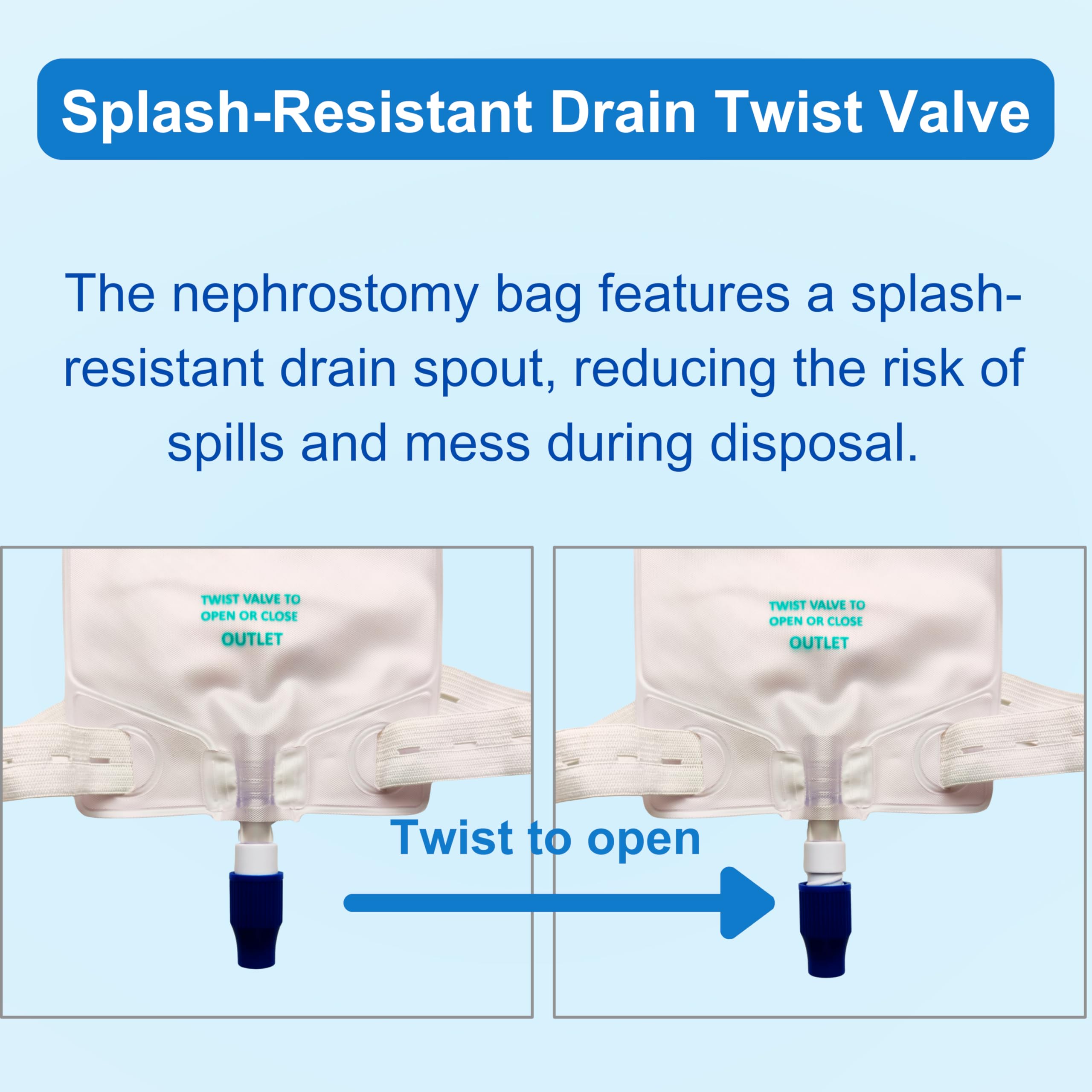 Use scenario showing nephrostomy/urostomy drainage with Filigan bag.