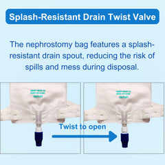 Use scenario showing nephrostomy/urostomy drainage with Filigan bag.