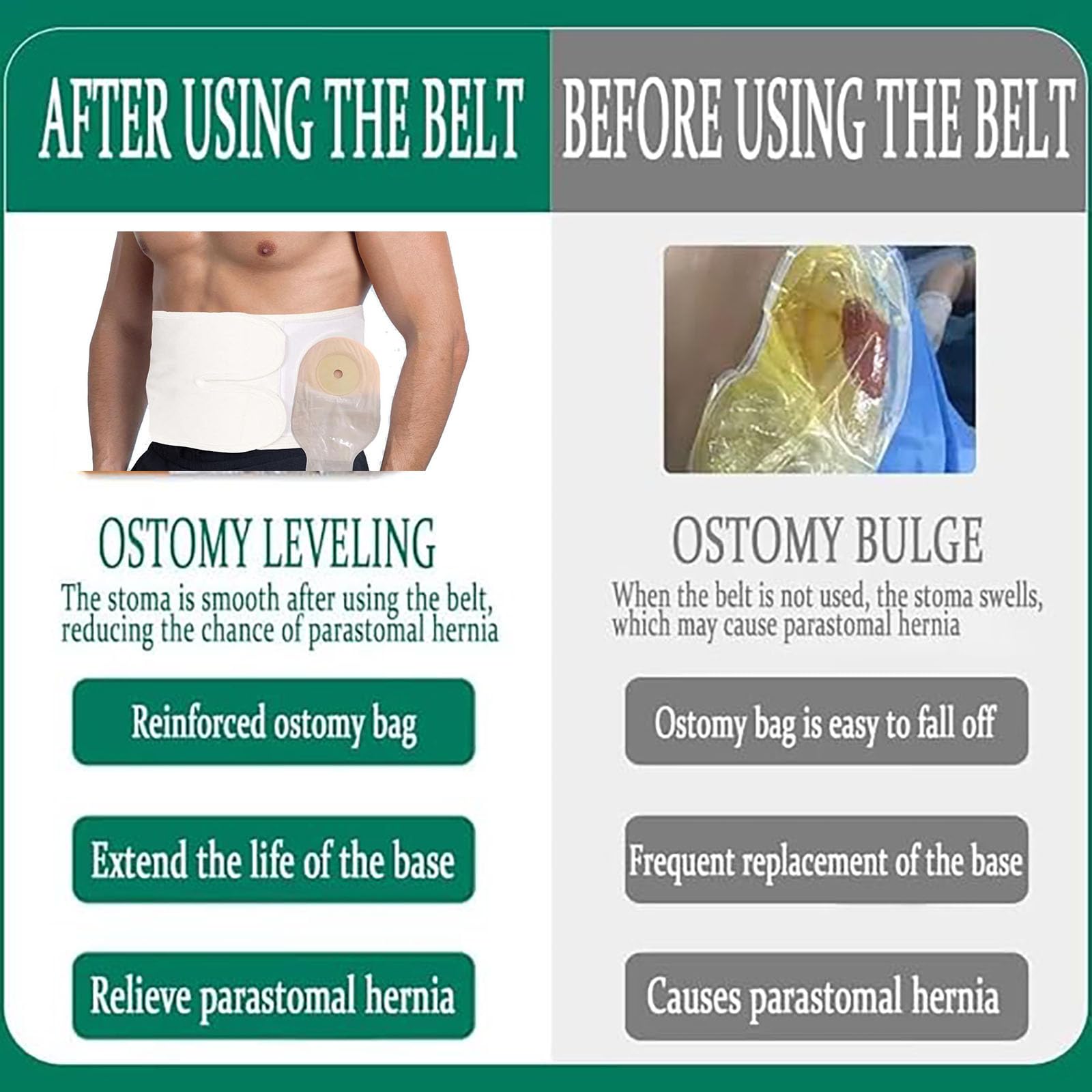 Flosmore ostomy belt is easy to put on and off, discreet under clothes.